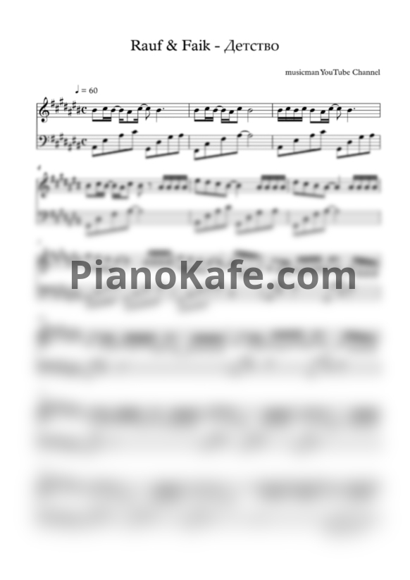 Ноты Rauf & Faik - Детство (musicman cover) - PianoKafe.com