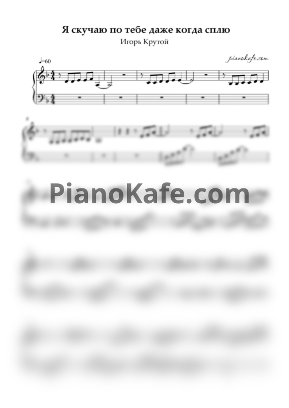 Ноты Игорь Крутой - Я скучаю по тебе даже когда сплю (Лёгкое переложение для фортепиано) - PianoKafe.com